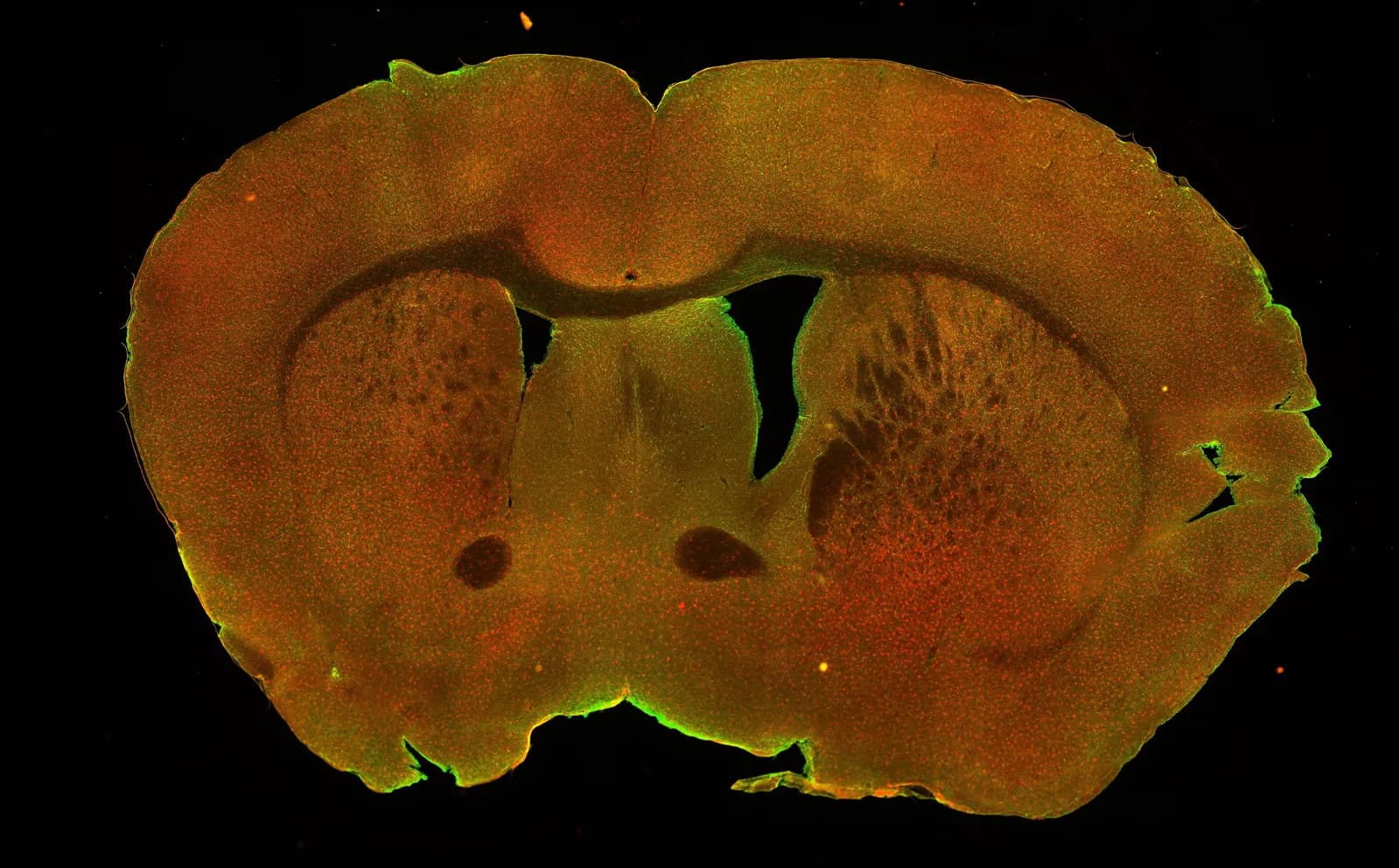 Fluorescent microscope image of a coronal section of a mouse brain.