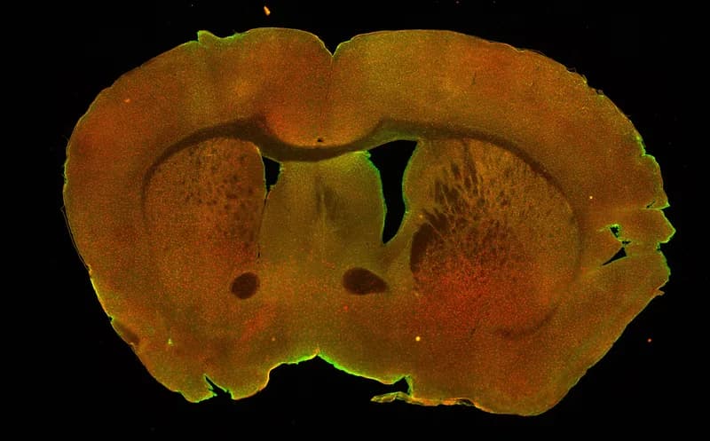 Fluorescent microscope image of a coronal section of a mouse brain.